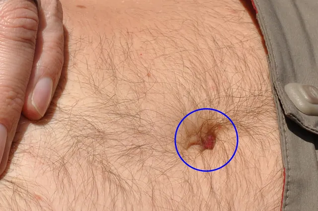 Three days worth of accumulated belly button fluff!