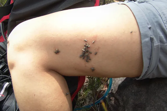 An army of flies took a liking to Naz's leech wound but she'd given up swatting them (gross)
