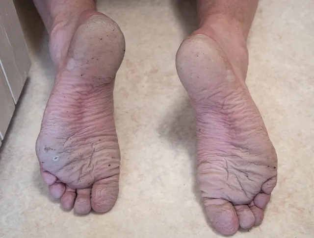 Wet and overgrown path vegetation led to a mild case of trench foot by lunch time. We dived into a hotel in Clovelly to avoid the rain