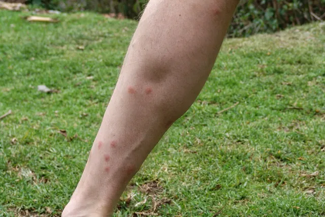 Damned mossies were having a field day on my leg ... very itchy